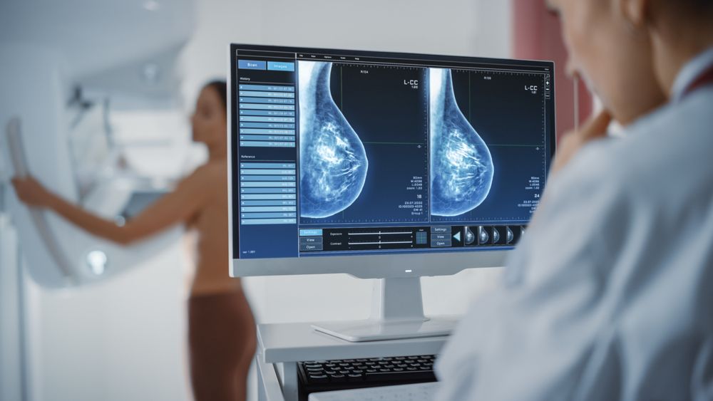 A doctor reviewing the results of a mammogram during a routine Cancer Screening