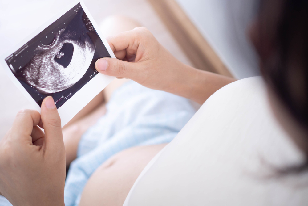 A pregnant woman is looking at an ultrasound photo of fetus.