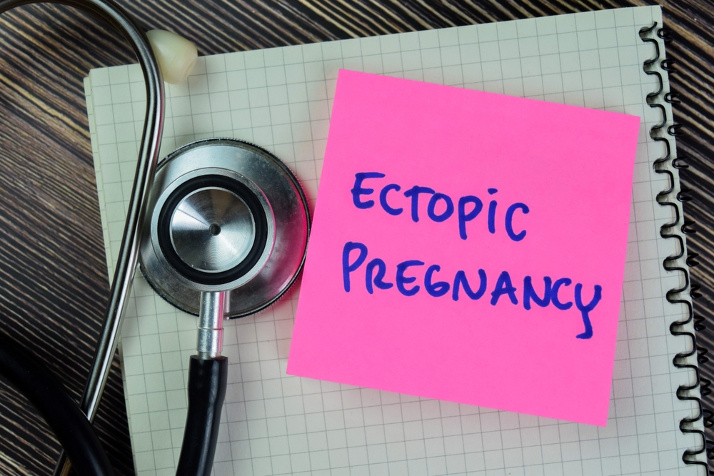 Concept of Ectopic Pregnancy write on sticky notes with stethoscope isolated on Wooden Table.