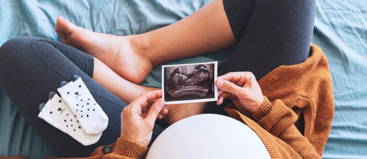 Pregnant woman holding ultrasound image.