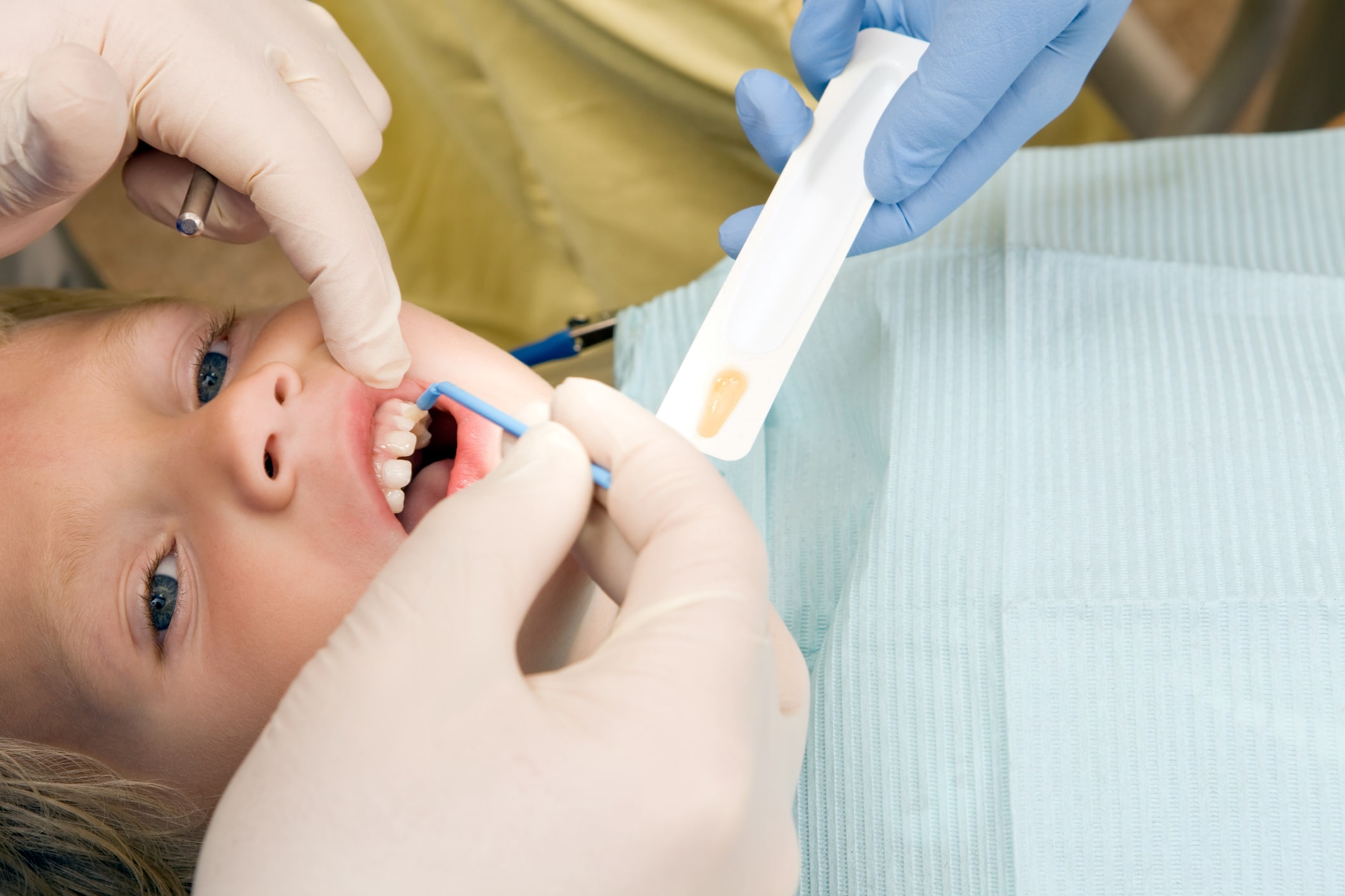 Child at a dentist appointment