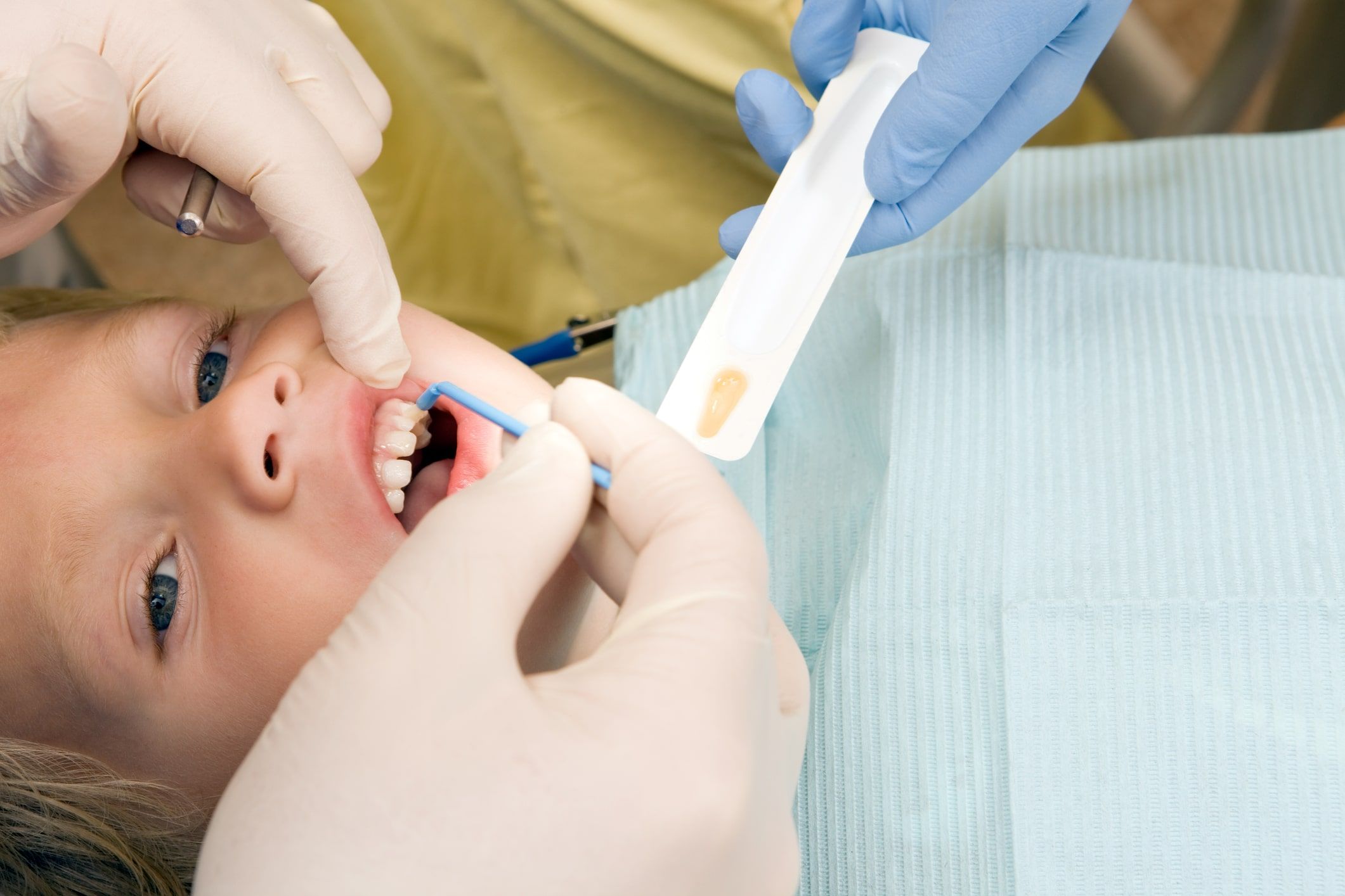 Kid during dental treatment