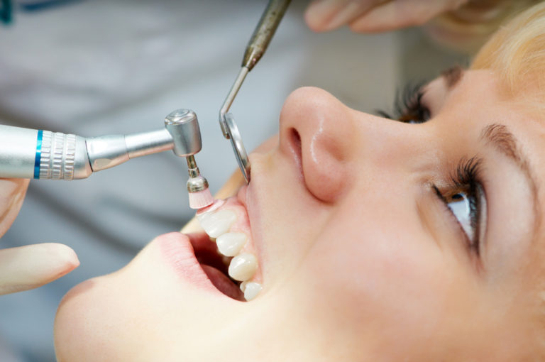 Dental Cleaning process