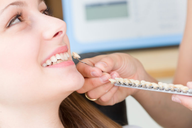 Veneers and Laminates process in dental clinic