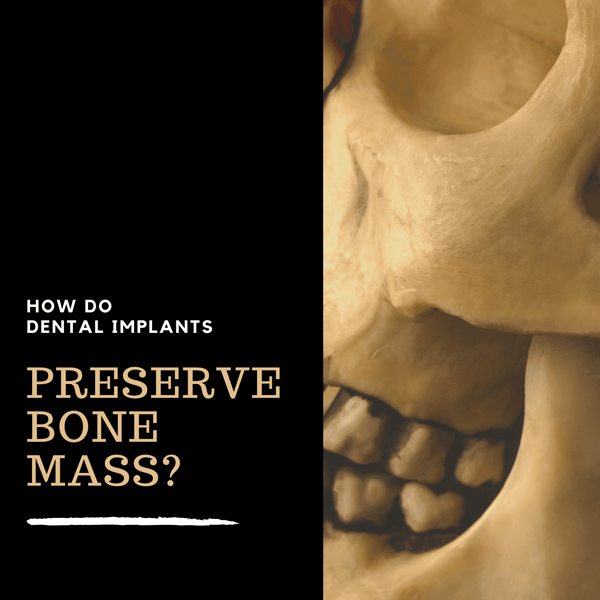 Dental Implants Preserve Bone Mass