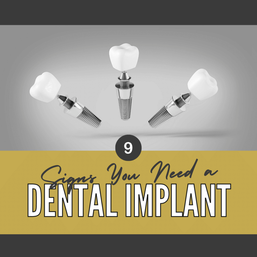 9 Signs You Need a Dental Implant