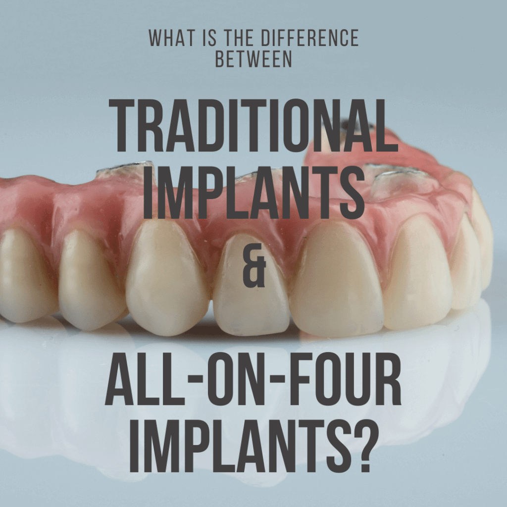 What is the Difference Between Traditional Implants
