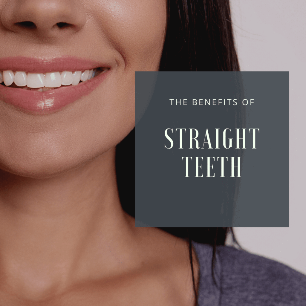 The Benefits of Straight Teeth