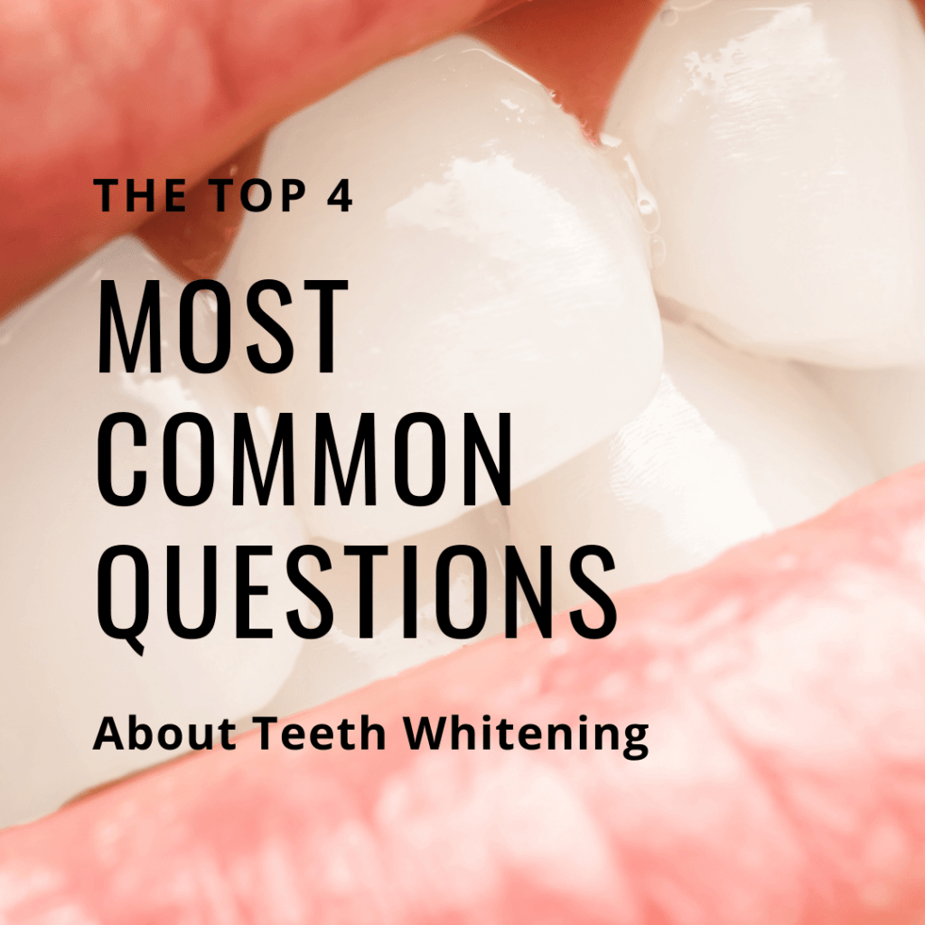 The Top 4 Most Common Questions About Teeth Whitening