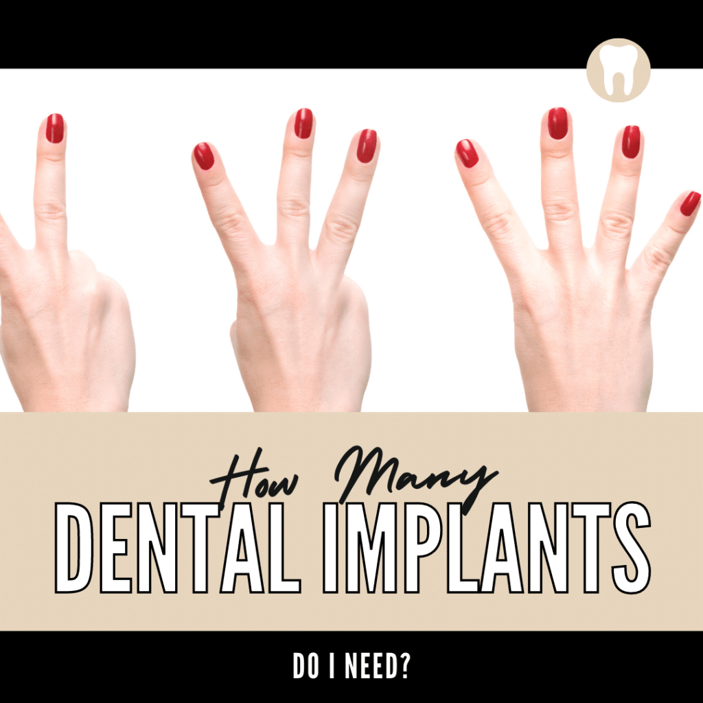 How Many Dental Implants Do I Need