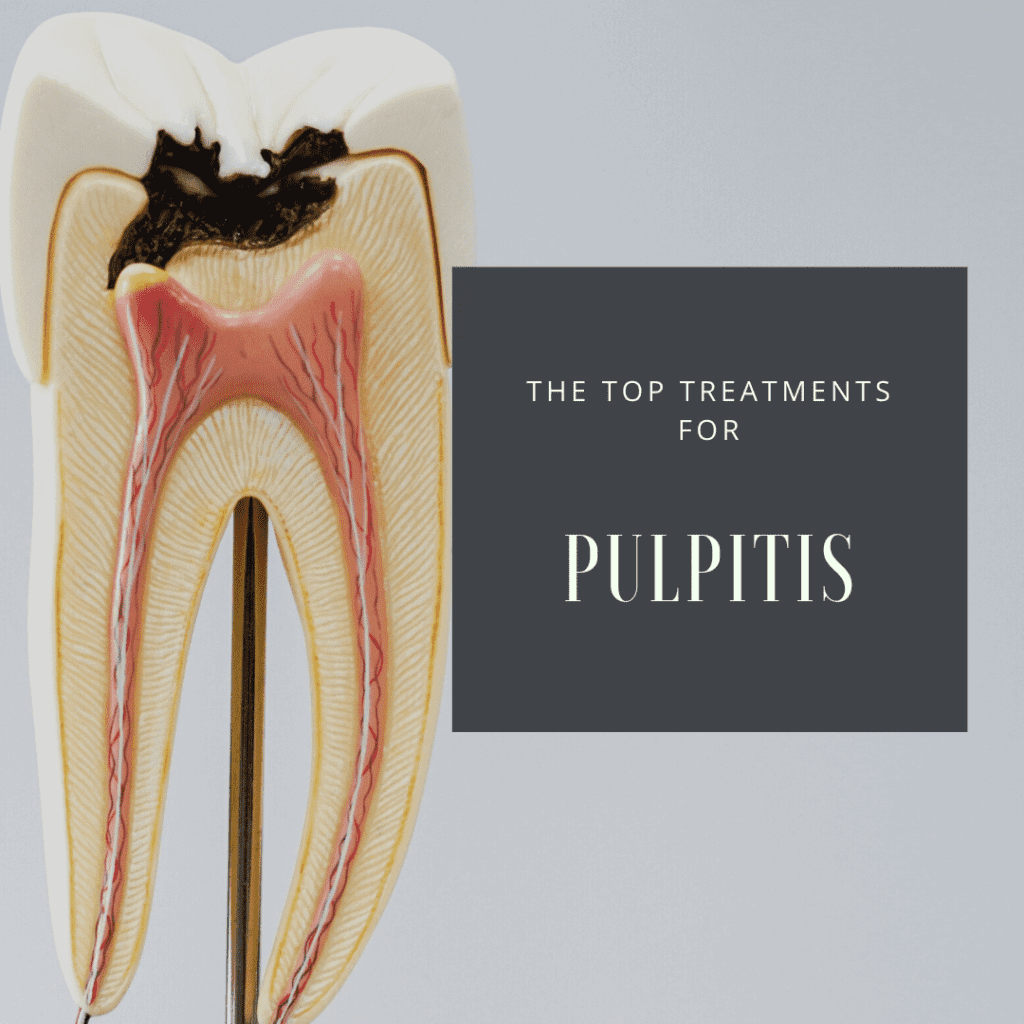The Top Treatments for Pulpitis