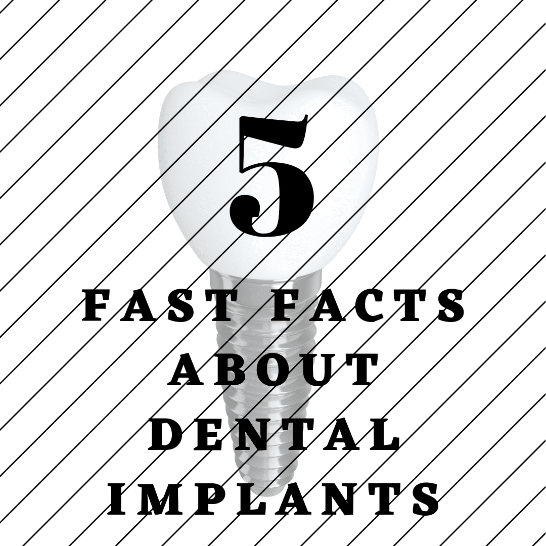 5 Fast Facts About Dental Implants