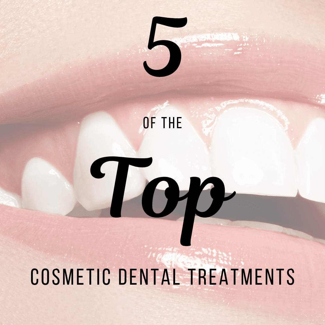 5 of the Top Cosmetic Dental Services