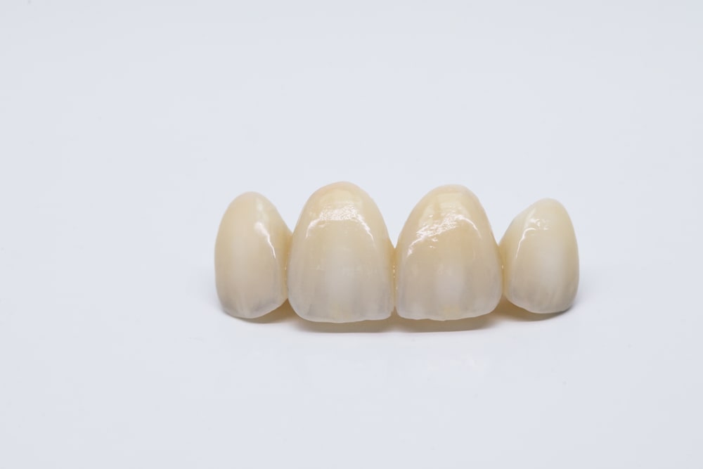 Dental ceramic bridge