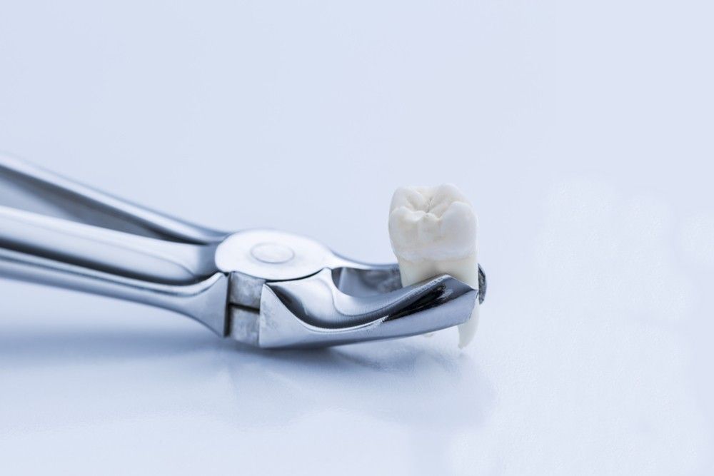 Pliers for wisdom tooth removal by a dentist