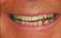 Dental Patient After Treatment