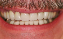 Dental Patient After Treatment