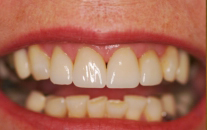 Dental Patient After Treatment