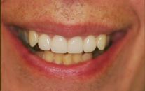 Dental Patient After Treatment