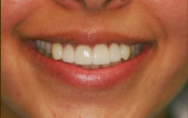 Dental Patient After Treatment