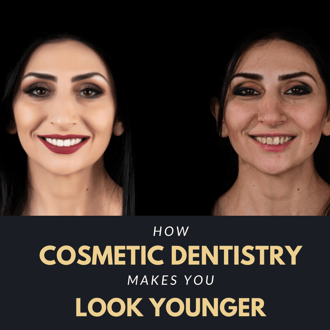 How Cosmetic Dentistry Makes You Look Younger