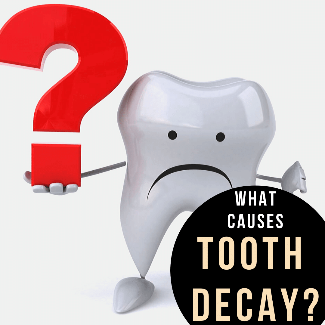 What Causes Tooth Decay?