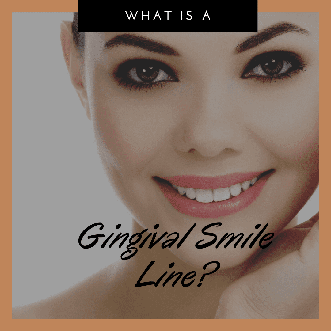 What is the Gingival Smile Line?