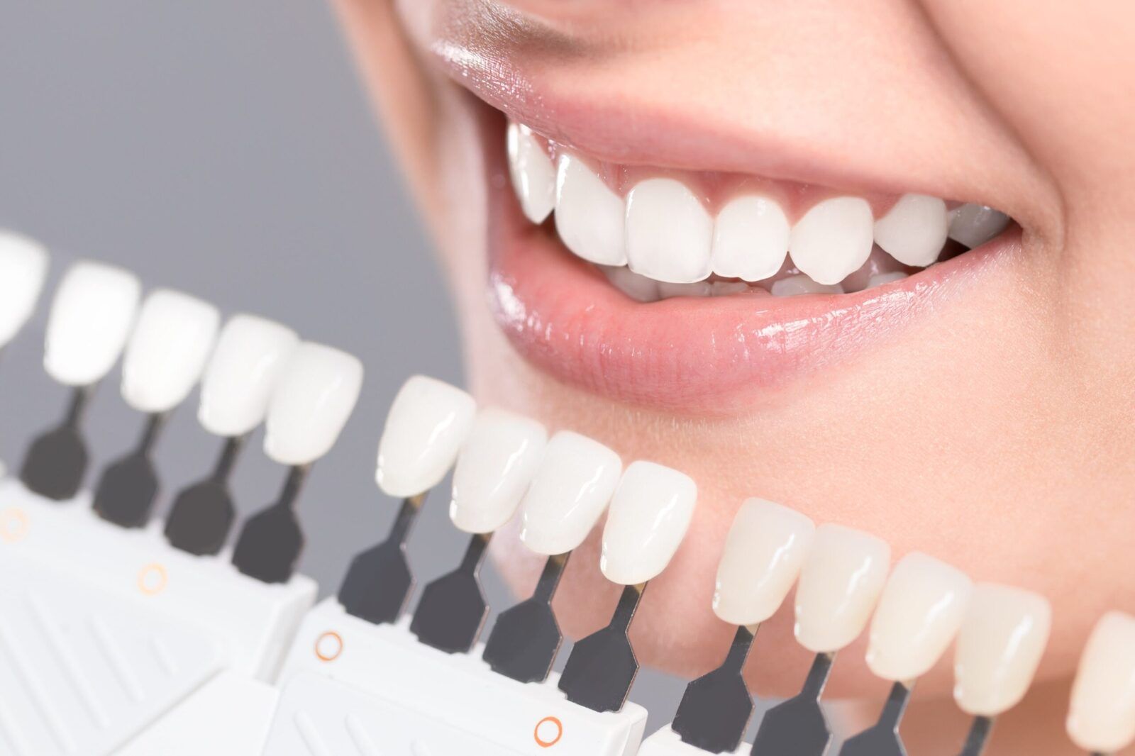 teeth against whitening shade guide