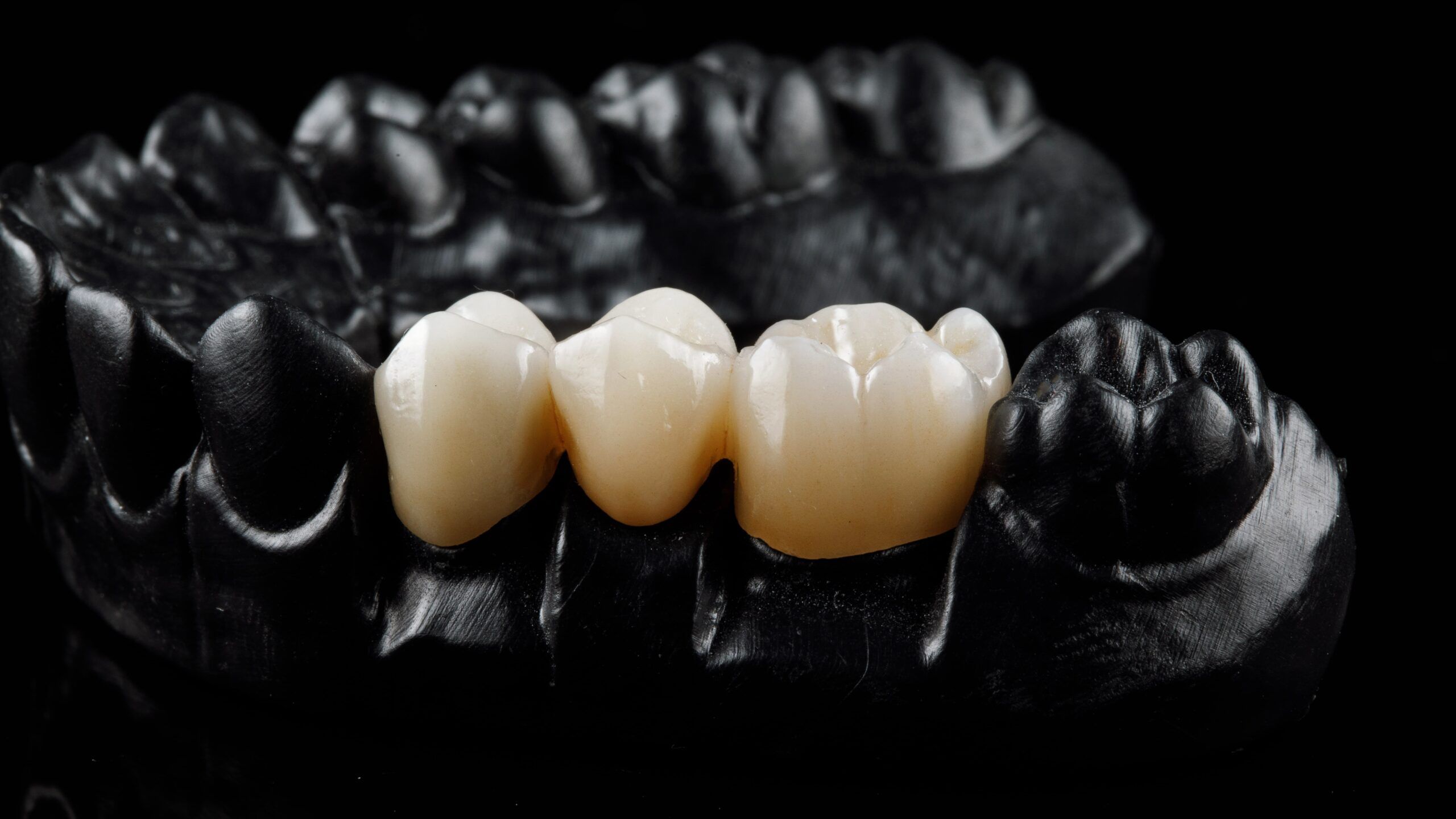 white dental bridge on a black tooth model
