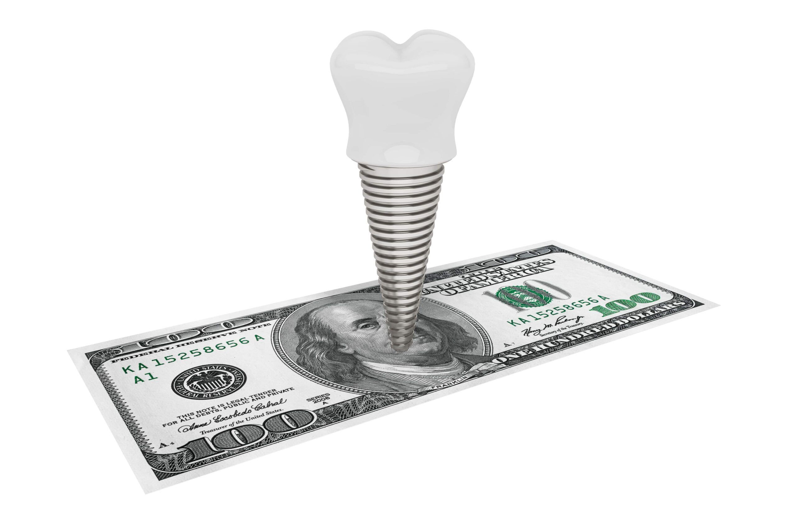 dental implant on $100 bill