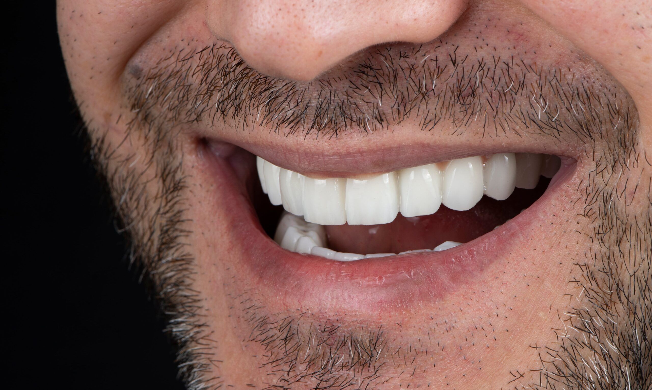 man smiling with perfect teeth