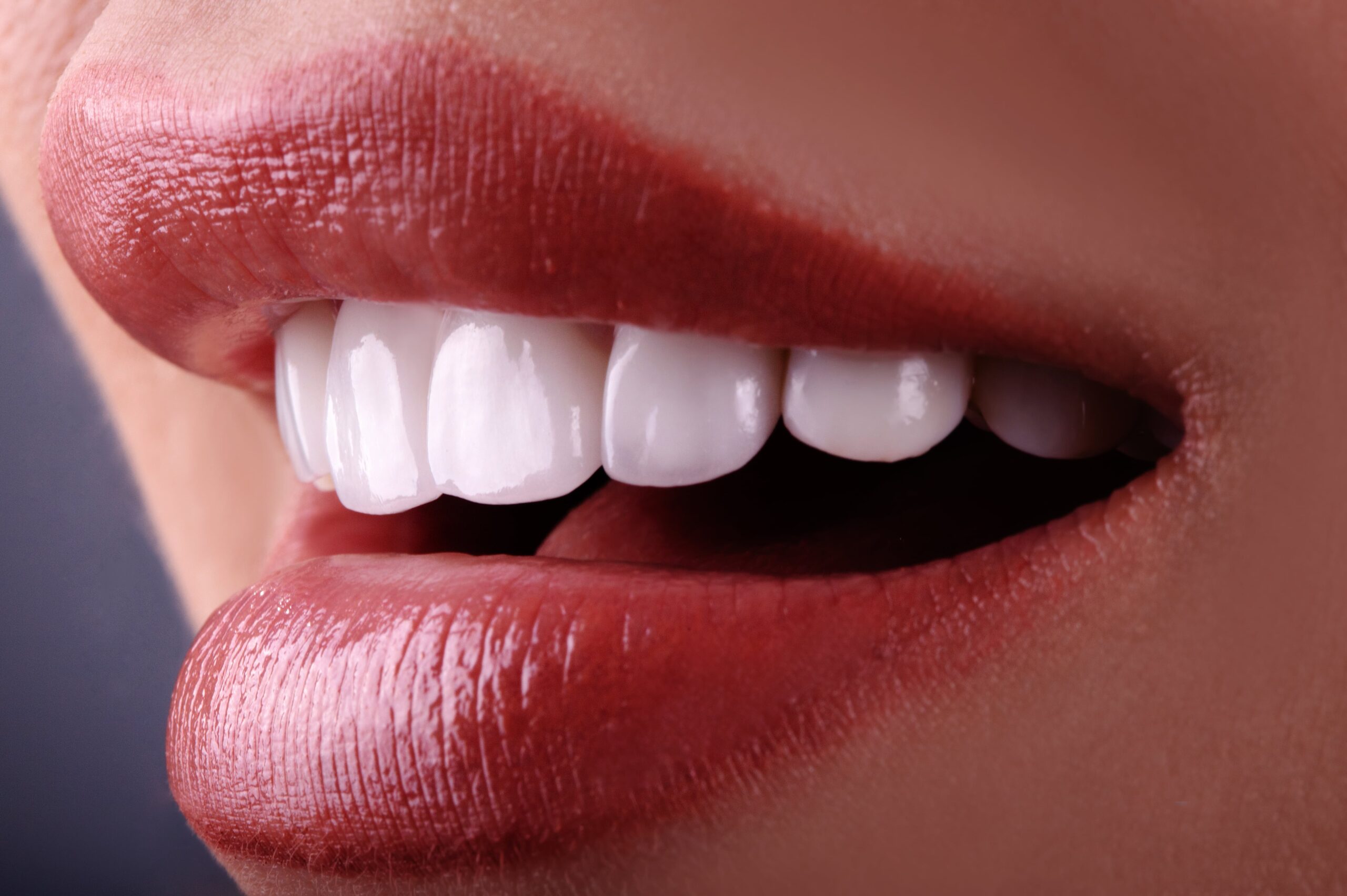 woman smiling with white teeth