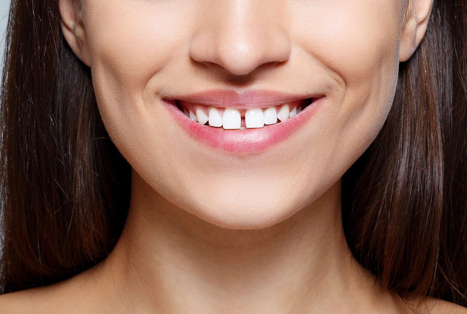 pretty woman smiling with gaps between her teeth