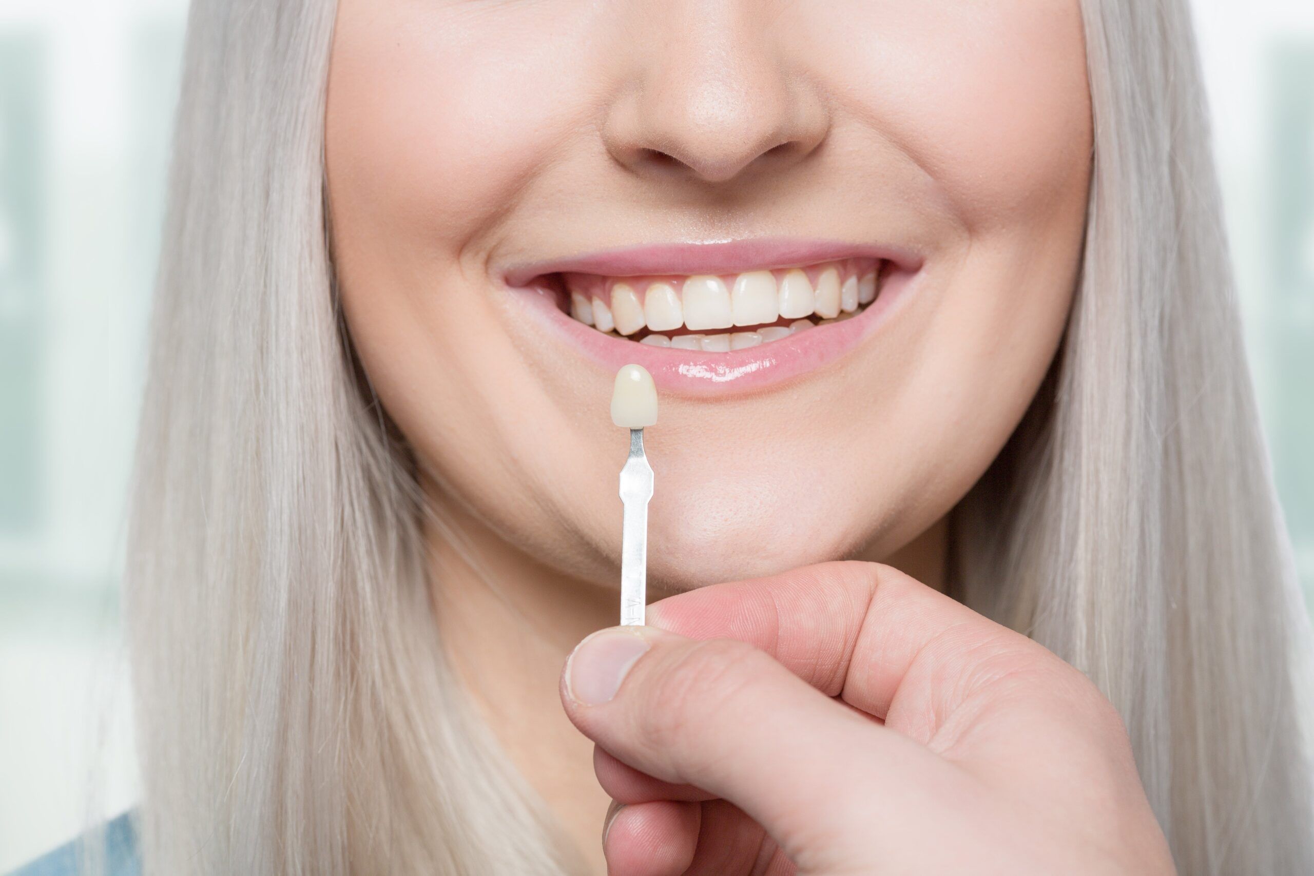 blonde being fit for veneers