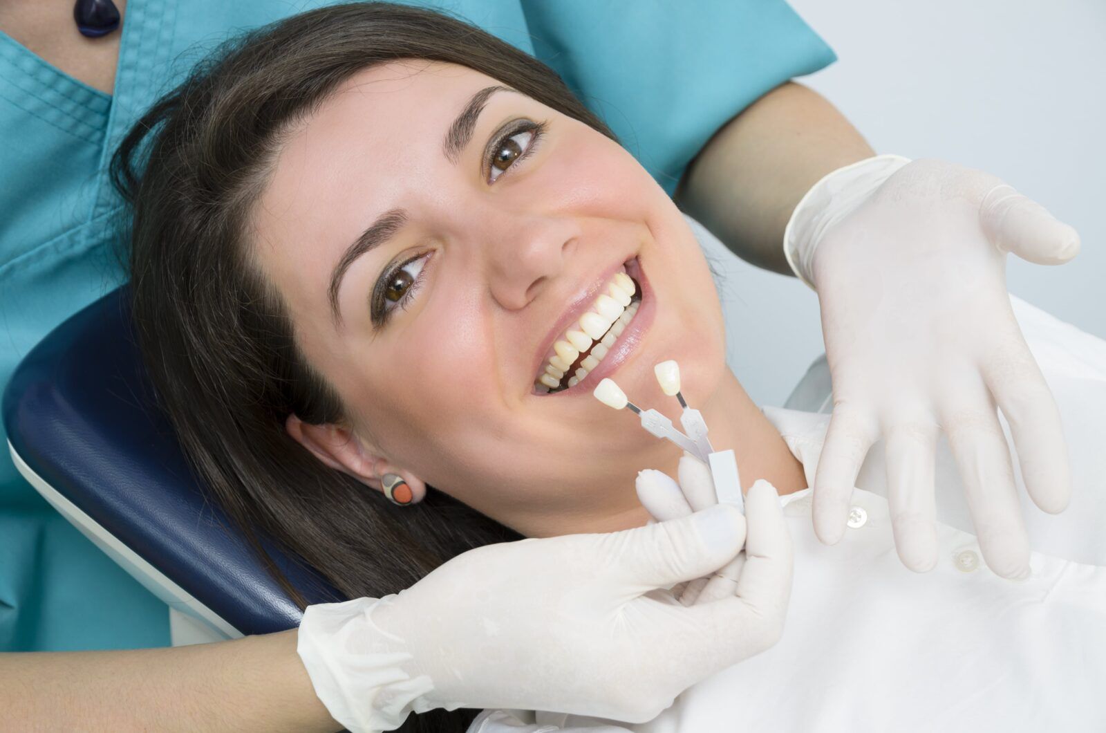 woman smiling and being matched for veneers or teeth whitening