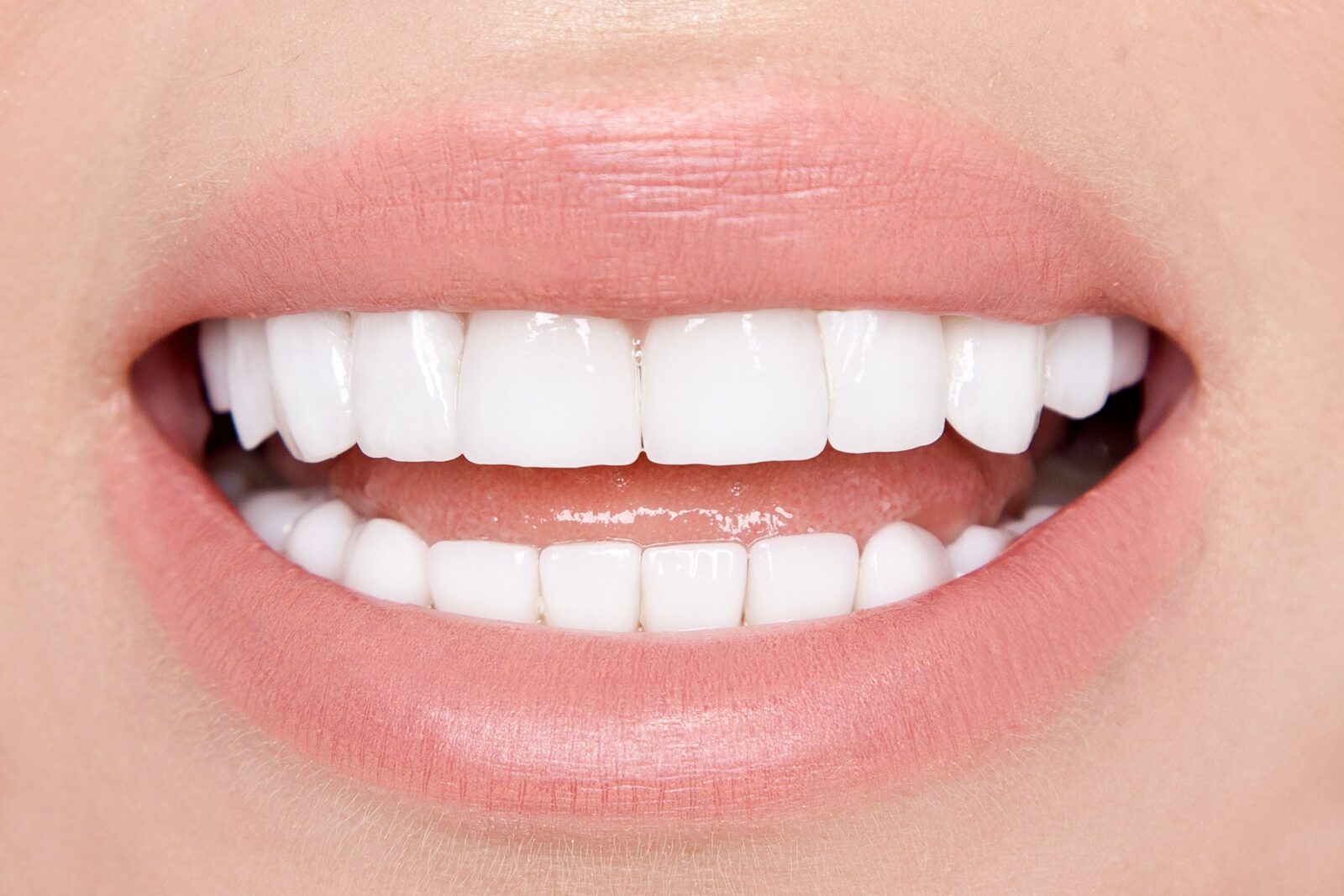 closeup of white smile