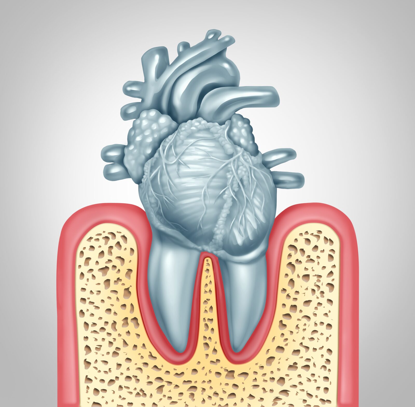 anatomical heart in tooth socket