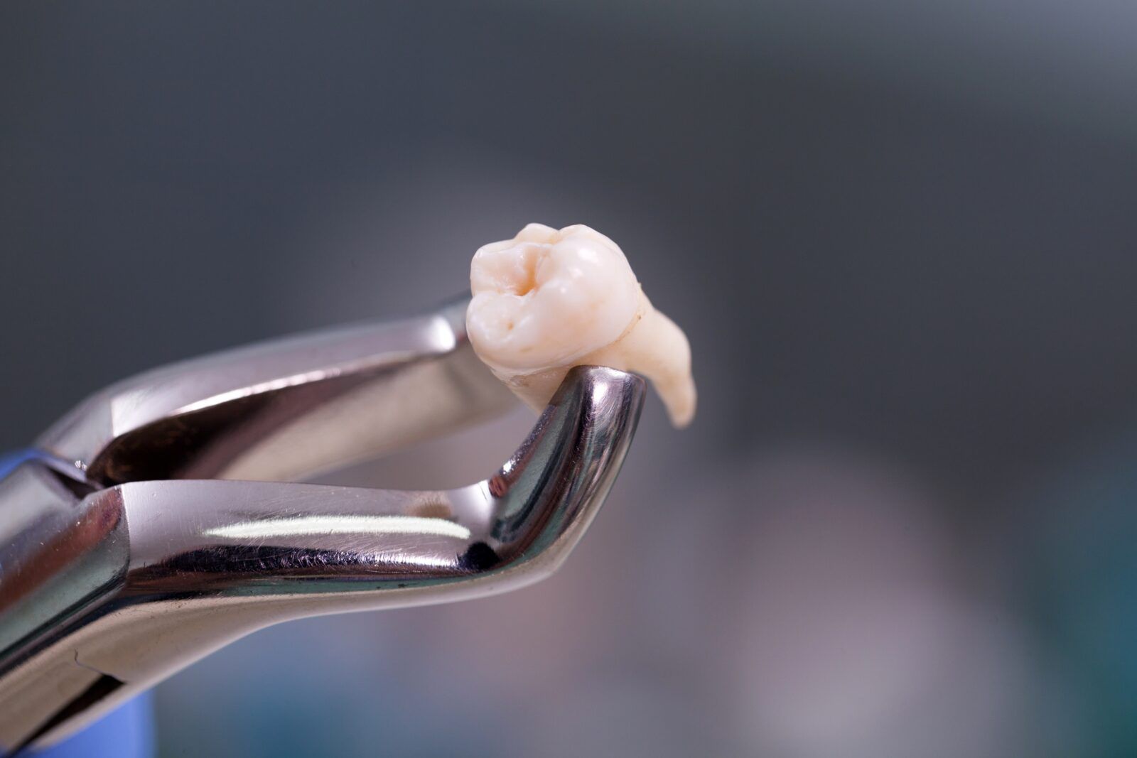 forceps holding extracted tooth
