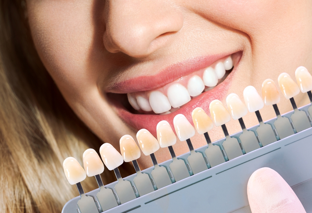 Debunking common myths about cosmetic dentistry