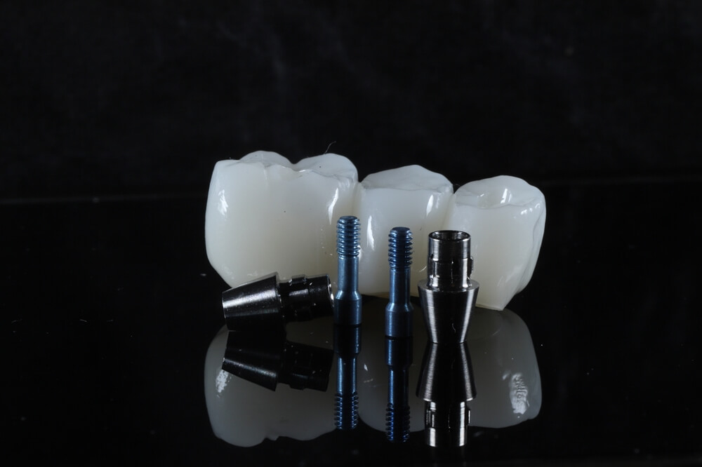 Dental implants