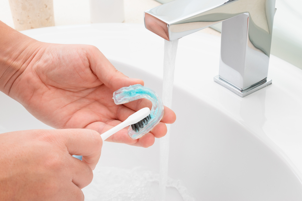 Washing and removing organic residues in orthodontic appliance.