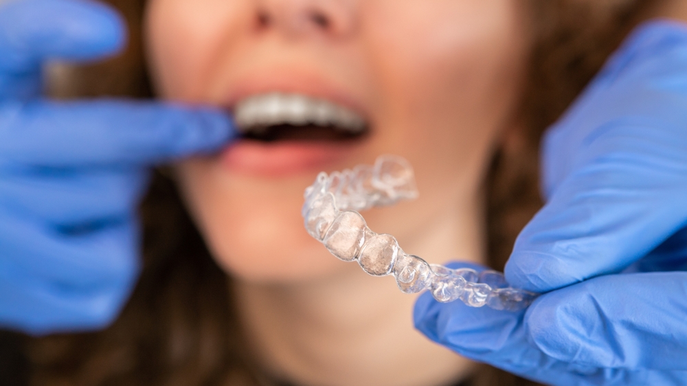 Orthodontist doctor in gloves putting silicone invisible transparent braces on woman's teeth