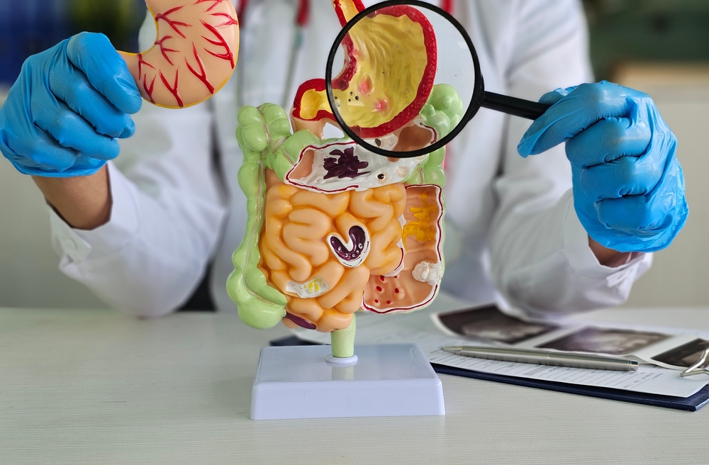 Magnifying glass and colon diseases and colorectal cancer and ulcerative colitis.