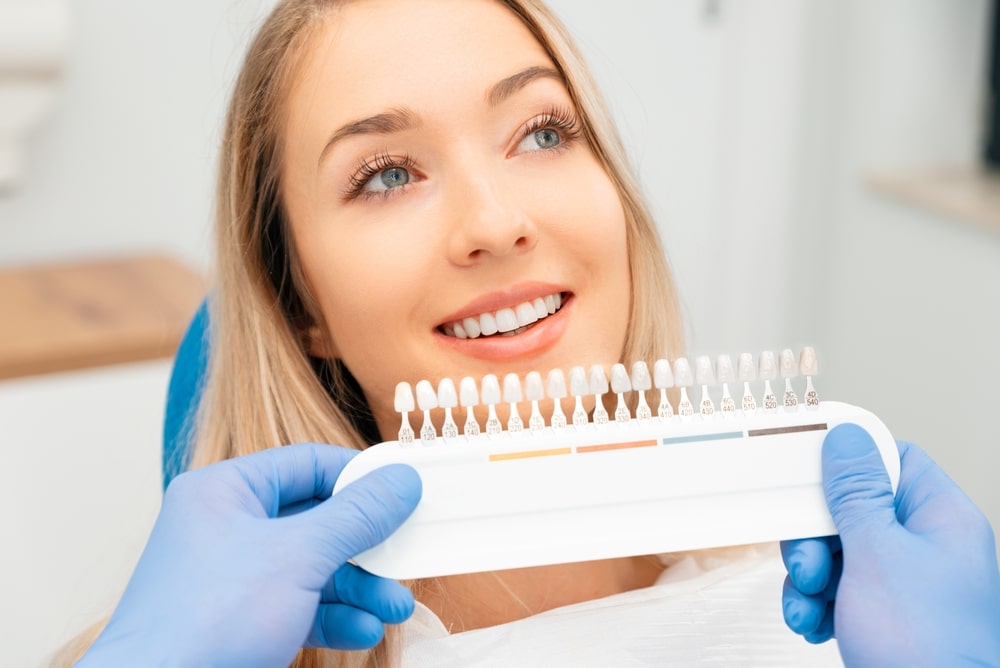 Choosing a shade of dental veneers. Teeth whitening