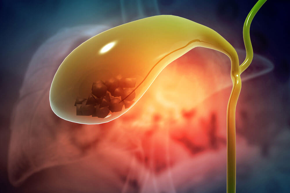 Gallbladder with stone. 3d illustration