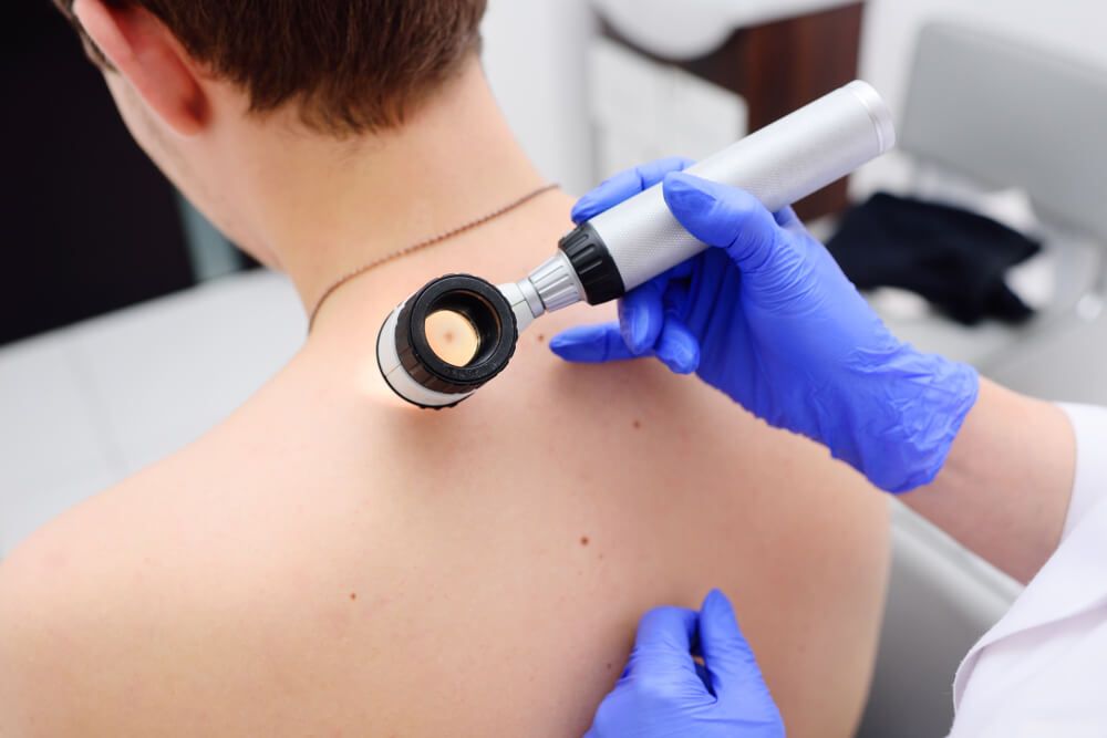 the doctor dermatologist examines birthmarks
