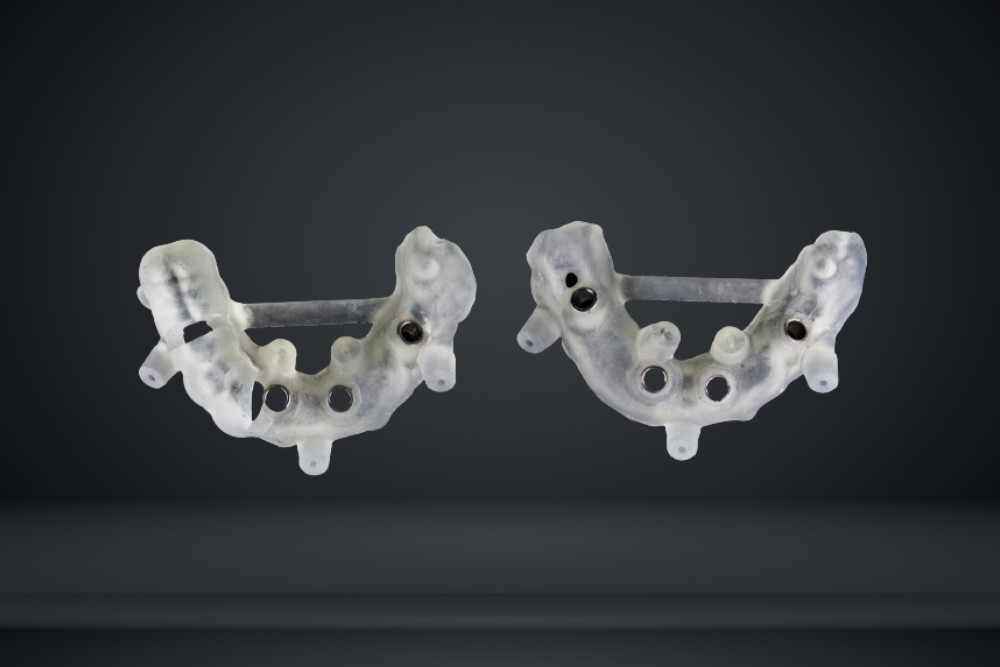 beautiful dental surgical template for precise implantation of the jaw of the patient