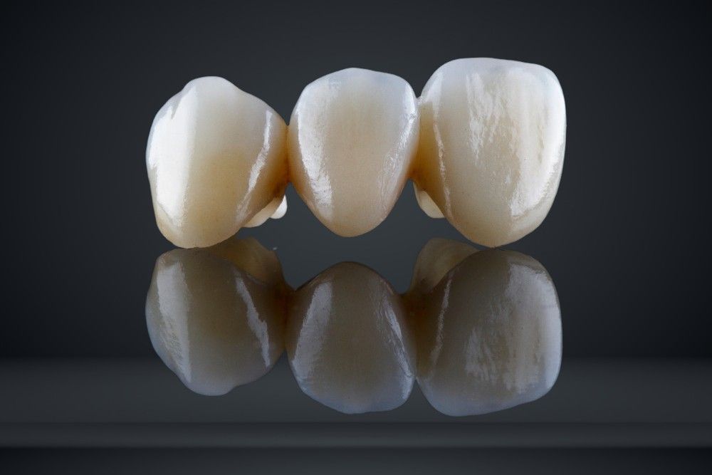 three beautiful dental crowns of natural color on black glass with reflection