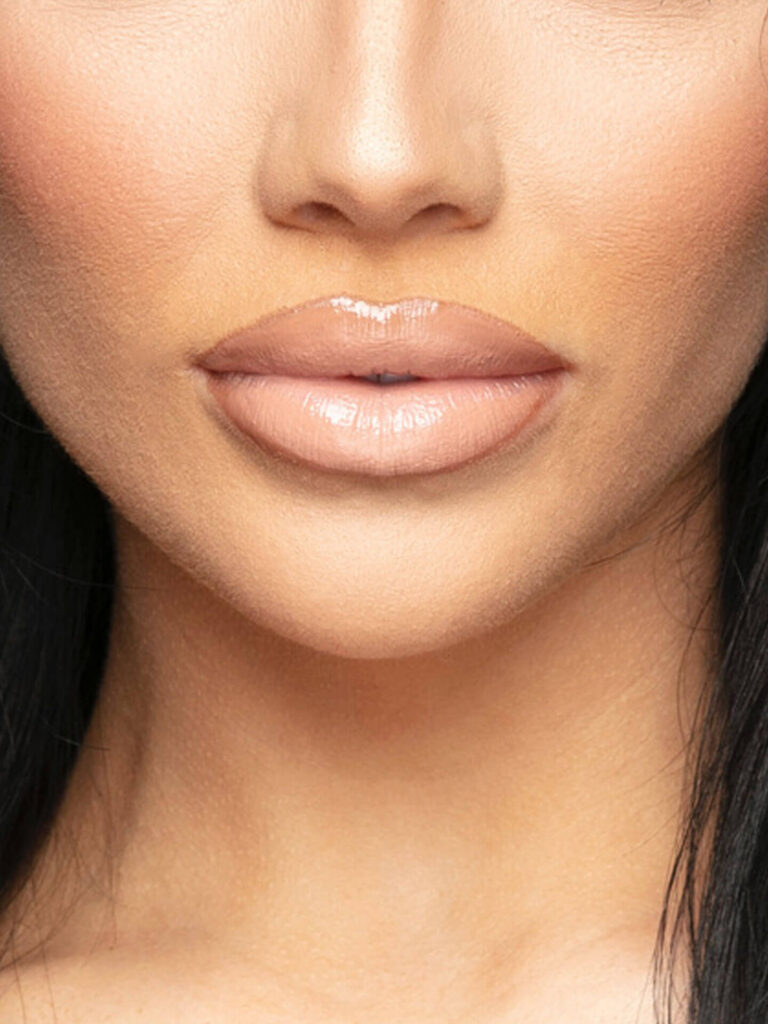 Girl with botoxed lips