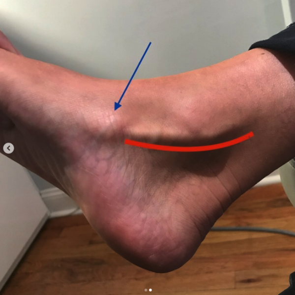 arrow pointing on foot